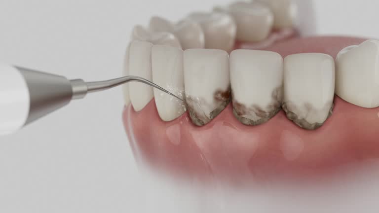 Trusted Dental Crowns And Bridges service in Linden, AL - Dentist Open Now
